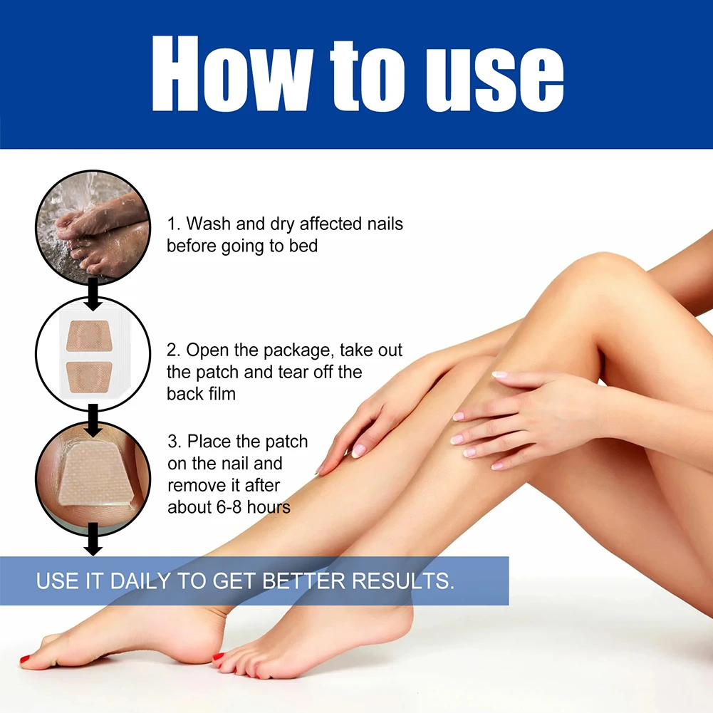 60Pcs Toenail Fungus Patch Sticky Nail Repair Patches Nail Ingrown Correction Stickers for Discolored Or Damaged Nails