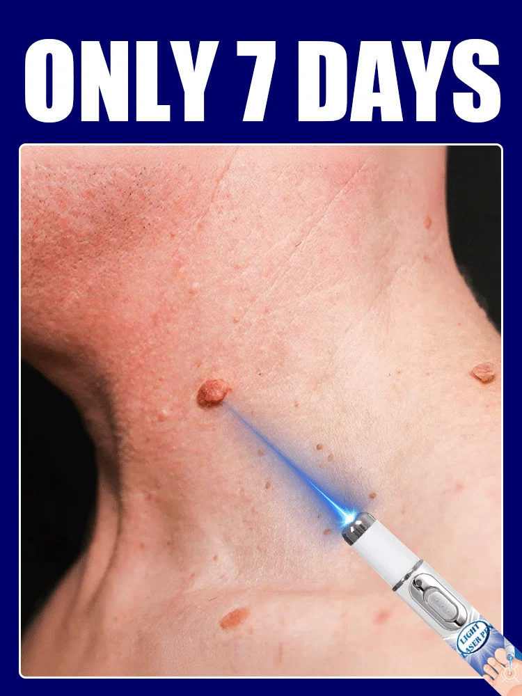 

2nd ᵍᵉⁿᵉʳᵃᵗⁱᵒⁿ ᵘᵖᵍʳᵃᵈᵉᵈ wᵃʳᵗ ⸴ ʳᵉpᵃⁱʳ wᵃʳᵗˢ ʳᵒoᵗ ⸴ ᑫᵘⁱᶜᵏˡʸ