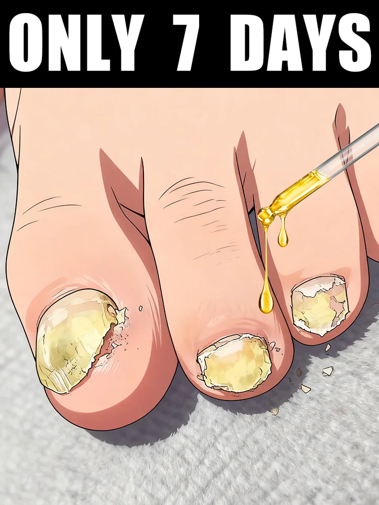 

Tᴏᴇɴᴀɪʟ Fᴜɴɢᴜs Pᴀᴛᴄʜᴇs Rᴇᴘᴀɪʀ Dɪsᴄᴏʟᴏʀᴇᴅ Dᴀᴍᴀɢᴇᴅ Nᴀɪʟs Fᴏᴏᴛ Cᴀʀᴇ2025