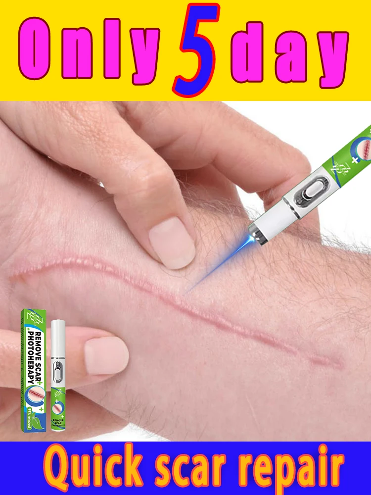 

Fᴀsᴛ ᴀɴᴅ ᴘᴀɪɴʟᴇss sᴄᴀʀ ʀᴇᴍᴏᴠᴀʟ, sᴇᴄᴏɴᴅ-ɢᴇɴᴇʀᴀᴛɪᴏɴ sᴄᴀʀ ʀᴇᴍᴏᴠᴀʟ ʟᴀsᴇʀ ᴘᴇɴ, ᴘʀᴏғᴇssɪᴏɴᴀʟ sᴏʟᴜᴛɪᴏɴ ᴛᴏ sᴄᴀʀ ʀᴇᴍᴏᴠᴀʟ ᴘʀᴏʙʟᴇᴍs