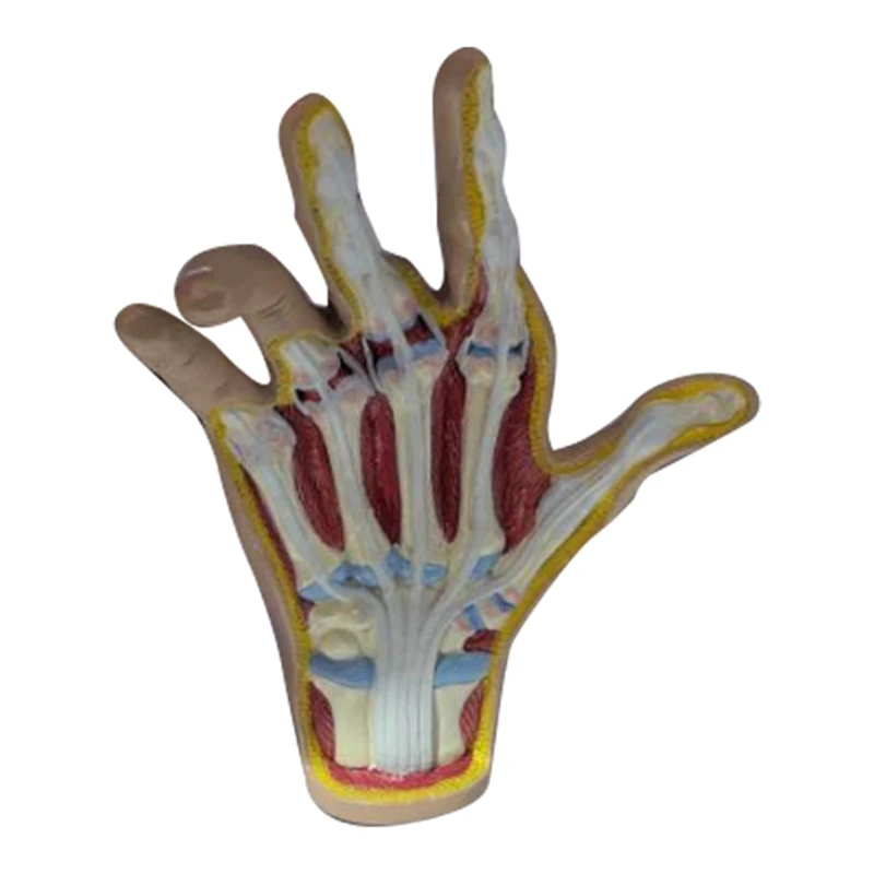 

Osteoarthritis Hand Model, Model Of Hand Pathology, Human Anatomy And Physiology Replica, 's Office Anatomy Model