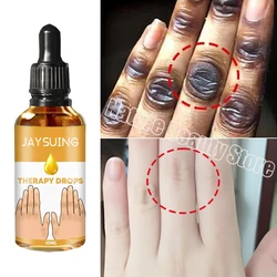 Dark Knuckles Fast Brighten Serum Elbows Hand Knuckle Brightening Serum Knee Black Skin Quickly Lighten Stains Remover Essence