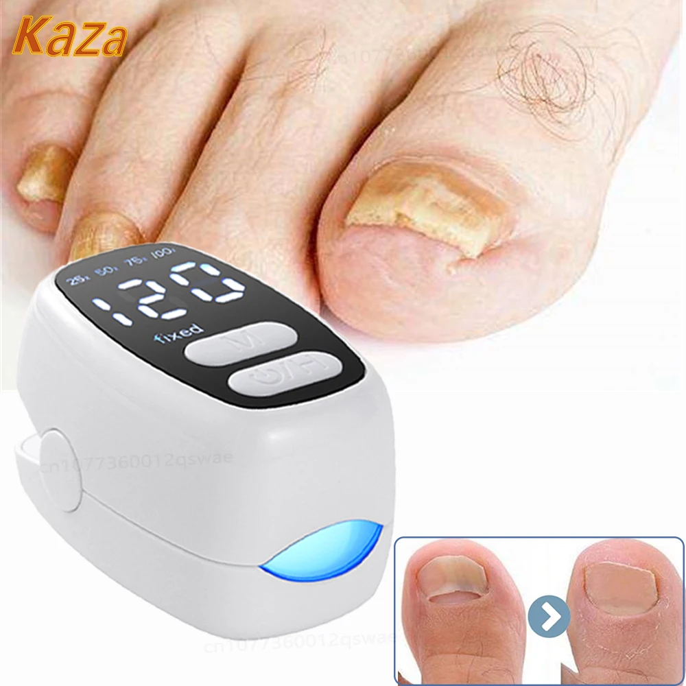 Nail Fungus Treatment LED Laser Device for Cleaning Onychomycosis Type-C Charge 905nm Infrared Light 470nm Nail Salon