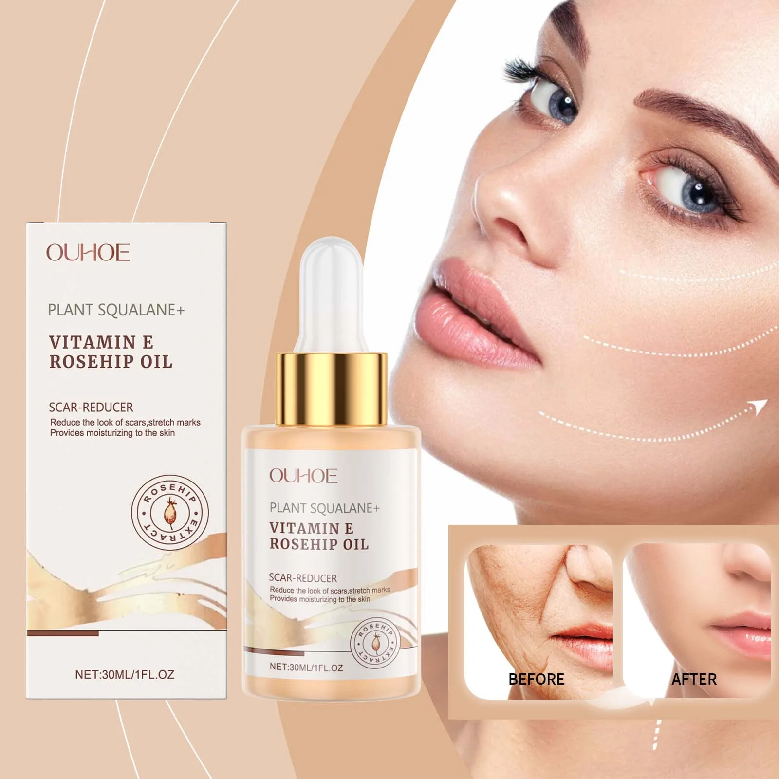 Fast Hydrating Squalane Rosehip Oil Fights Scars Anti-wrinkle Anti-Aging Reduce Fine Lines Glow Moisturizing Korean Skin Care