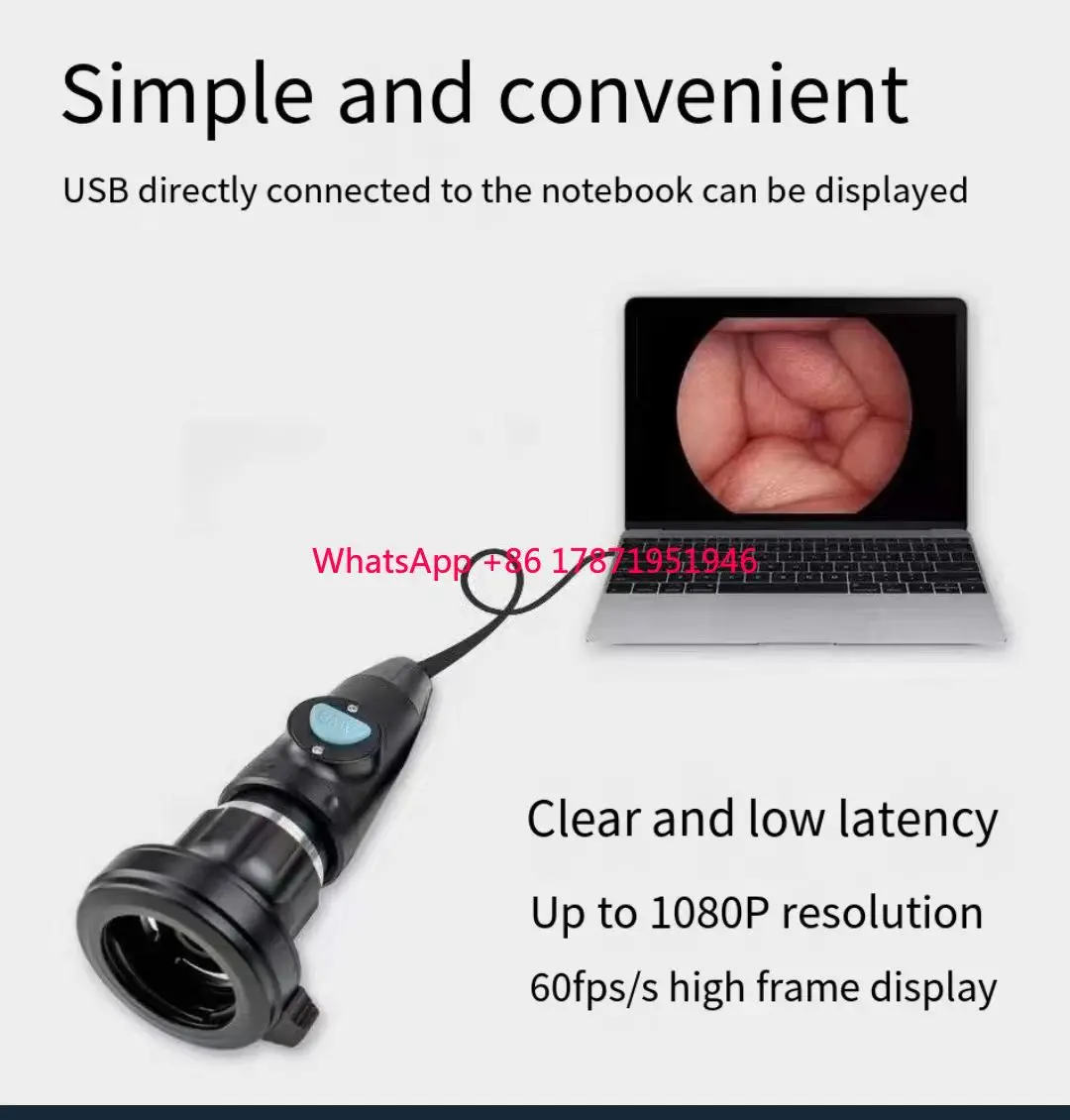 USB3.0 1080P Full HD Portable Human Clinic Hospital Veterinary ENT Endoscope Camera System