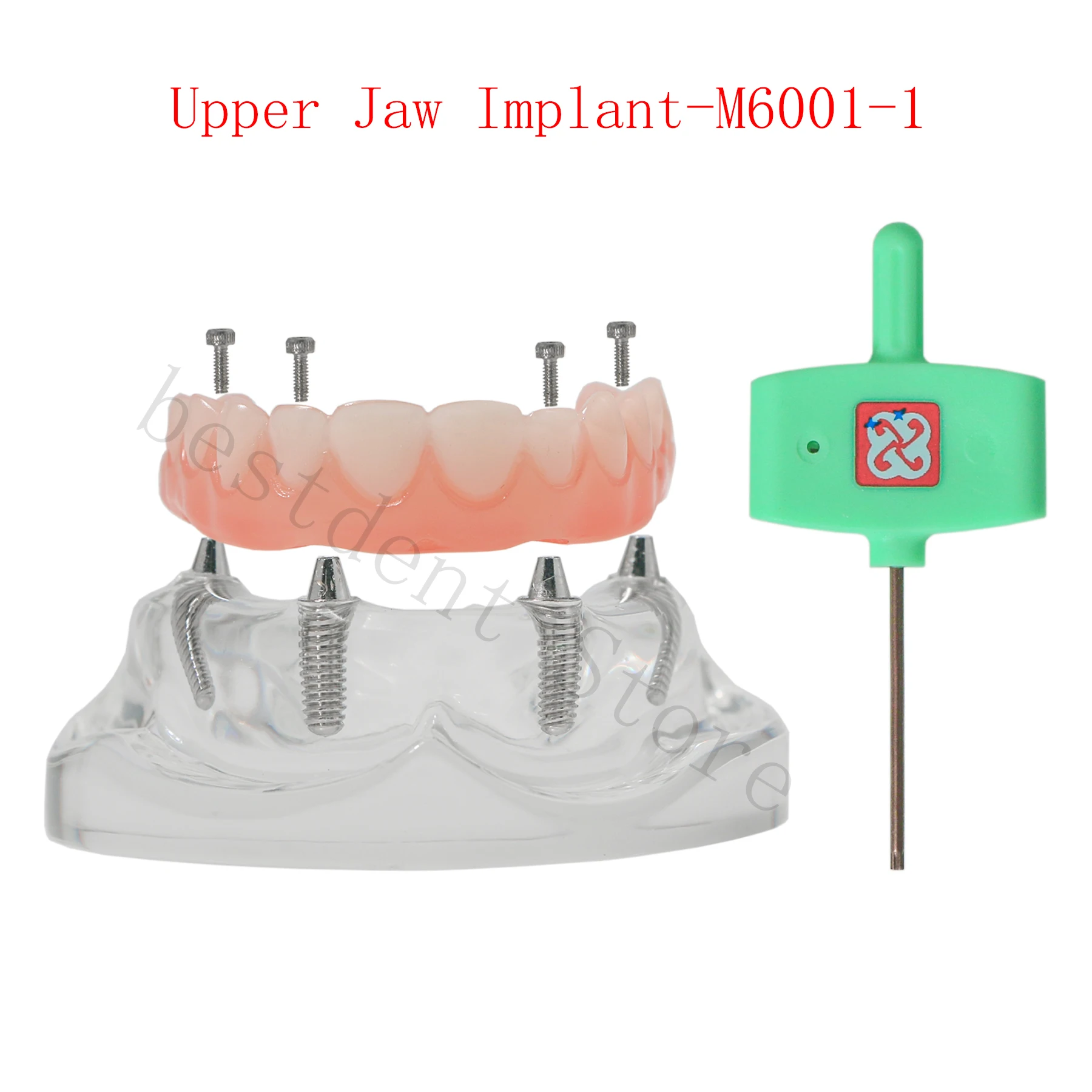 Dental Overdenture Typodont Transparent Tooth Model M6001-1 Upper Jaw Implant Restoration With 4 Screws