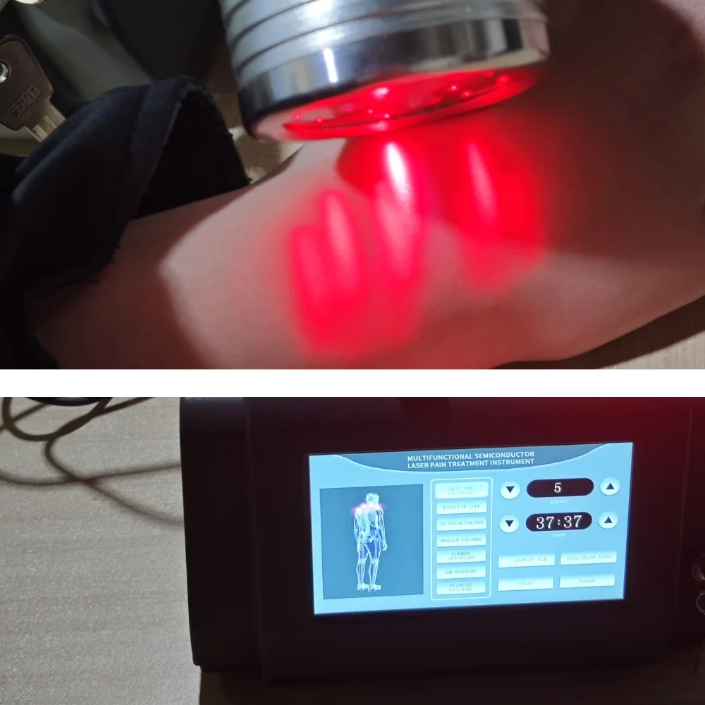 

Medical Chiropractic Laser Therapy 1055mW, Professional LLLT Equipment for Pain Relief, Low Level Semiconductor Laser Device