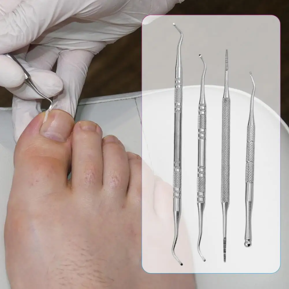 Juego de herramientas profesionales para uñas de los pies, Kit de eliminación de uñas de los pies de acero inoxidable para tratamiento seguro, pedicura de precisión