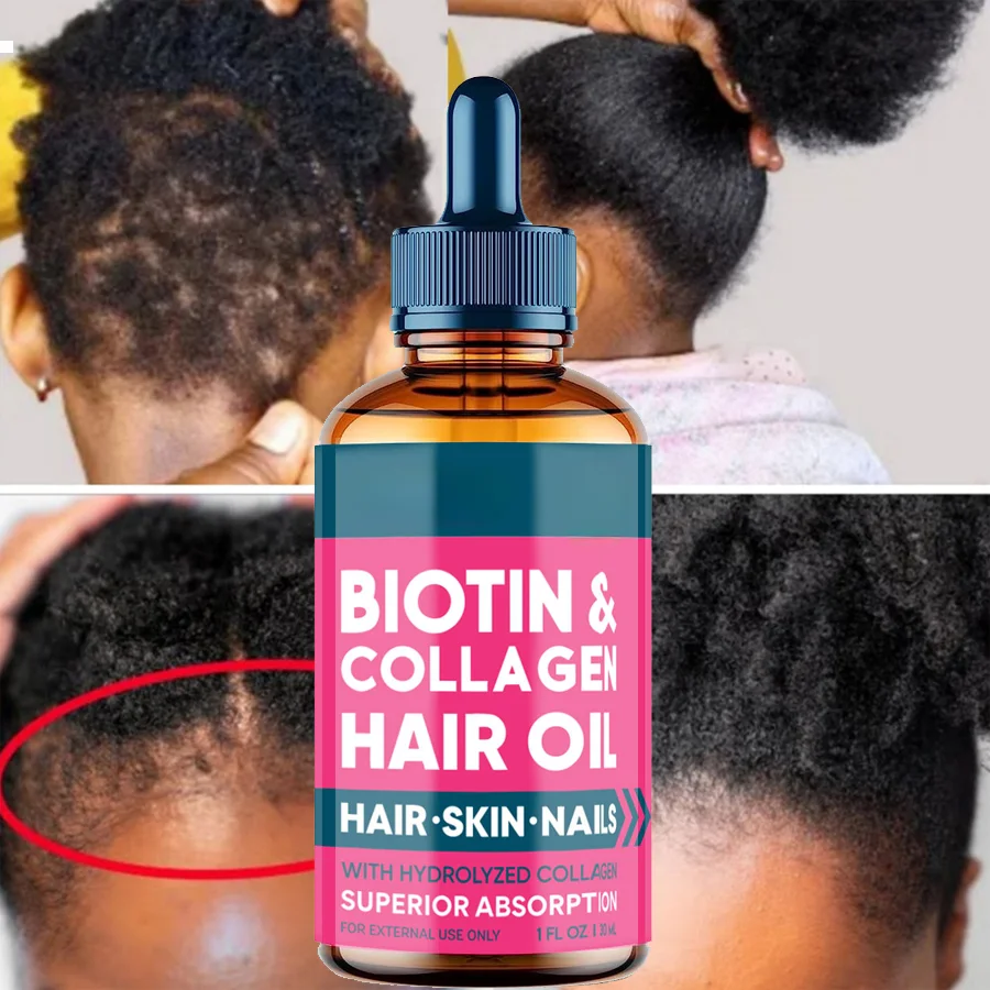 

1 (10) Biotin, быстрорастущие эфирные масла для ухода за волосами, масло против выпадения волос, увлажняющее волосы, для мужчин и женщин