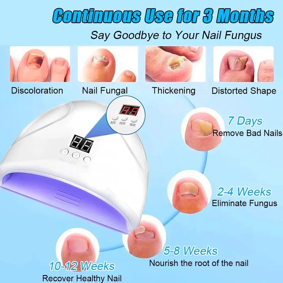 Fungal Nail Laser Device Fast Repair Essence Oil Repair Toenail Fingernail Treatment Onychomycosis with Mushrooms Foot Care