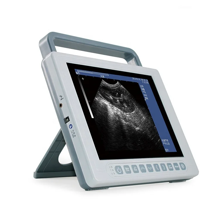 

China Manufacturer China Ultrasound Machine Veterinaryfor Sale