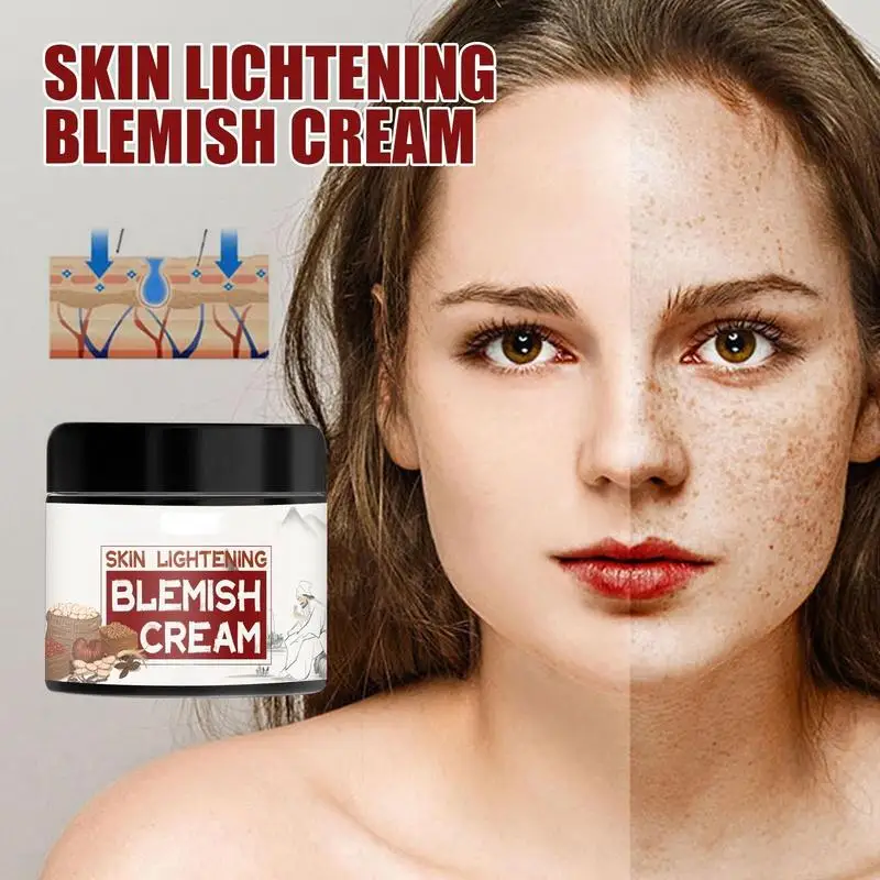 

Become Beauty Ginseng Extract Whitening Cream Remove Freckles Whitening Freckle Spots Cream