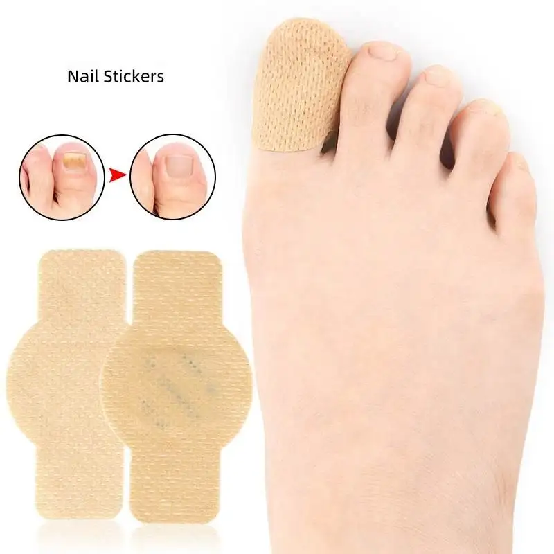 1/21pcs Waterproof Nail Fungus Patch Ingrown Toenail Correction Sticker Damaged Gray Nail Repair Care Feet Tools