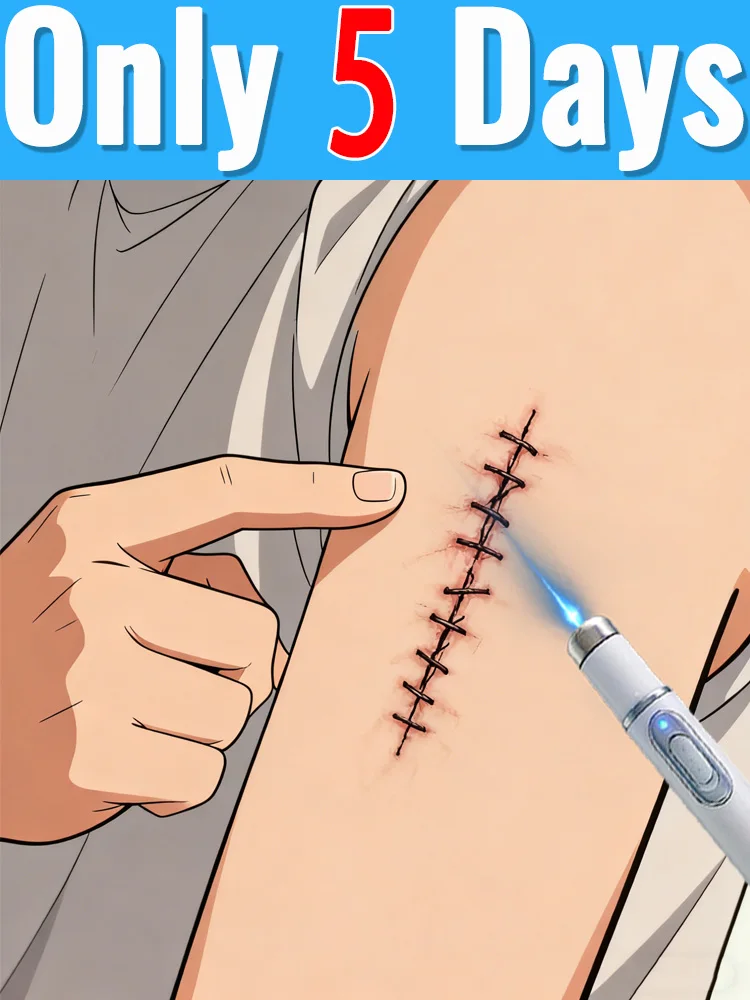 

Mᴇᴅɪᴄᴀʟ-Gʀᴀᴅᴇ Lᴀsᴇʀ Sᴄᴀʀ Rᴇᴍᴏᴠᴀʟ: ᴵⁿʰⁱᵇⁱᵗˢ ᔆᶜᵃʳ ᴳʳᵒʷᵗʰ ᵃⁿᵈ ᑫᵘⁱᶜᵏˡʸ ᶠᵃᵈᵉˢ