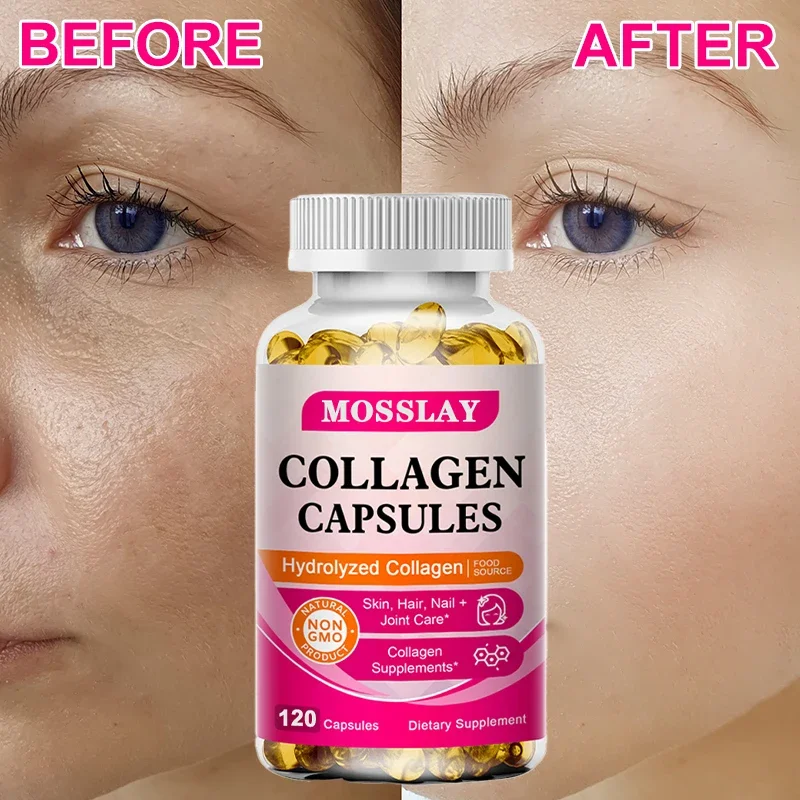 

Collagen Capsules - Promotes Healthier, More Youthful-looking Skin, Hair, Nails, and Joints, Antioxidant