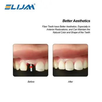 10 best sales Diş vidası - №4