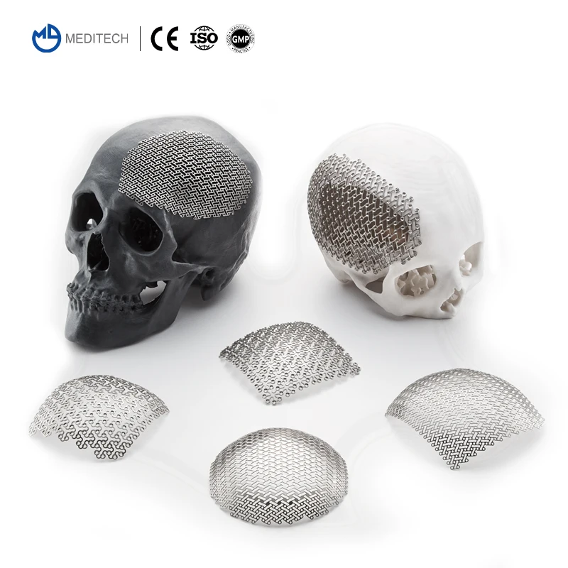 MEDITECH Orthopedic Surgical Maxillofacial Neurosurgery System Cranial Implant Titanium Mesh Plate for Skull Cranioplasty