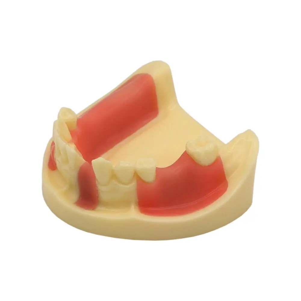 Dental Teeth Model Lower Jaw Removable Gingiva Implant Teeth Practice Demo Typodont Teeth Model M2004