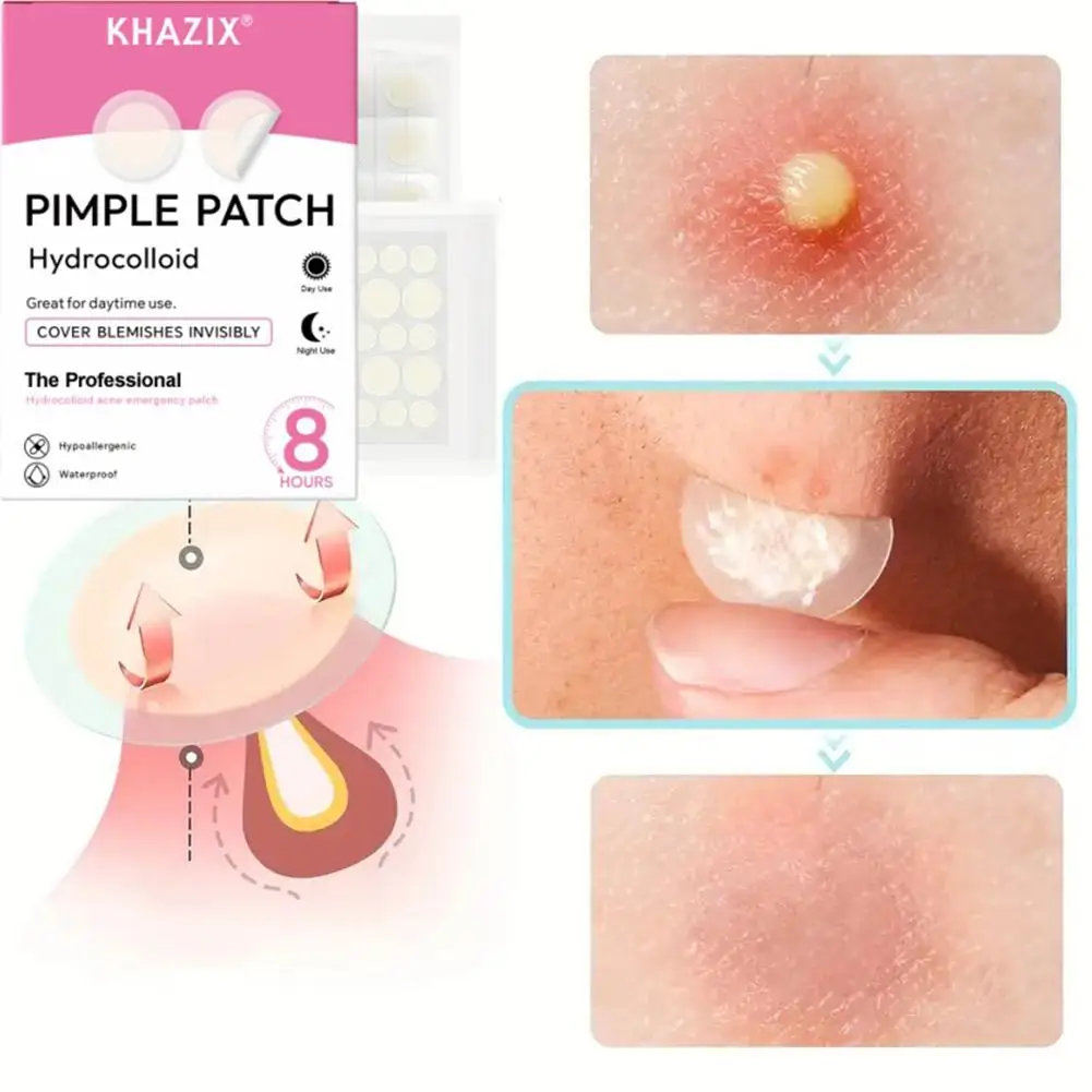 الوجه حب الشباب التصحيح أحجام نقطة مختلطة بثرة بقع غير مرئية العناية بالبشرة تغطية عميقة حب الشباب الجلد ودية بثرة إخفاء ملصق #2