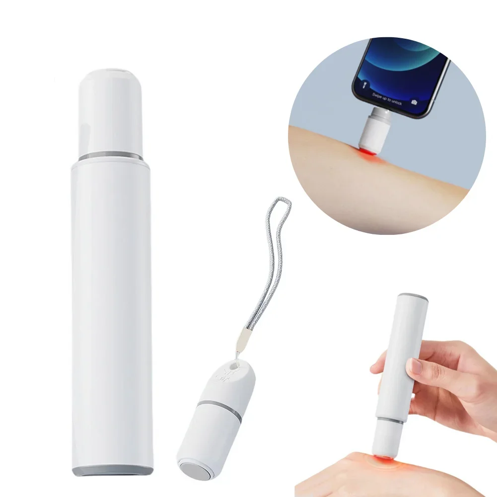 

Ручка от укусов комаров, снимающая зуд, портативная натуральная терморучка от укусов комаров, электрический зажигатель от укусов насекомых для взрослых и детей