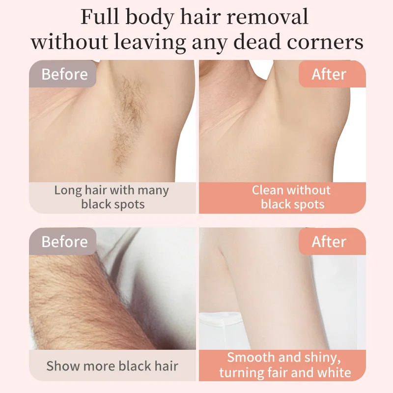 Bikini Trimmer for Women - Painless Electric Razors for Silk Skin,Cordless Body Shaver for Trip,Replaceable Lady Facial Razor image 3