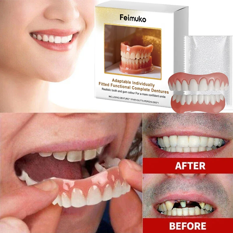 Thumbnail 2 - #76 Compare Dentures Before You Buy