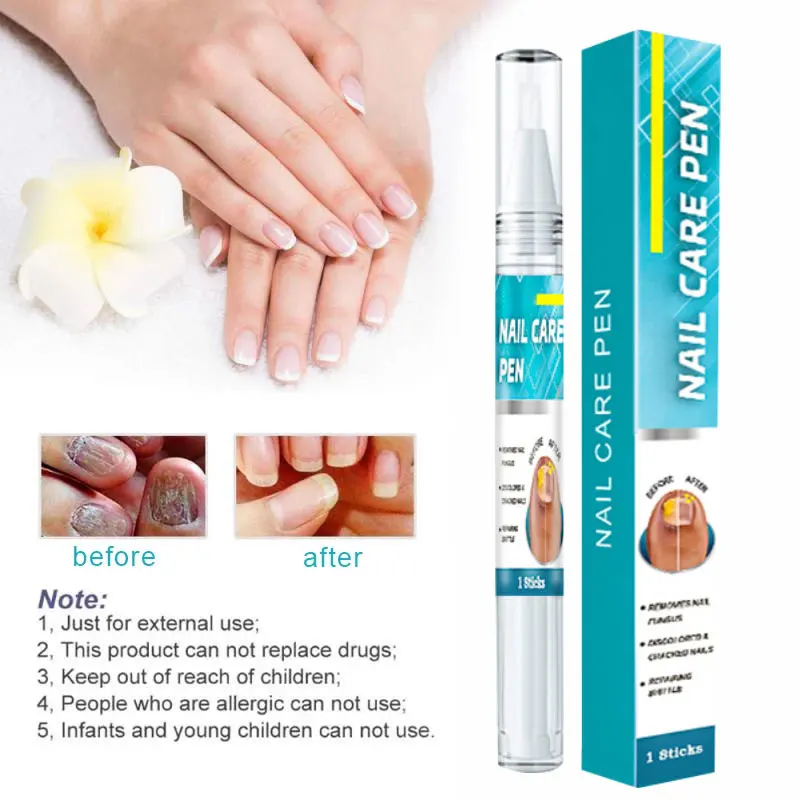 Cura delle unghie Soluzione per il trattamento dei funghi Mani Piedi Anti-Infezione Ispessimento delle unghie Curling Peeling Atrofia Onicomicosi 3ml