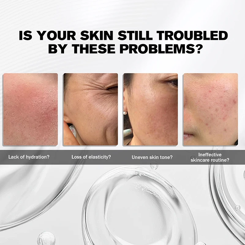 Volufiline 100% Plump Essence Flasche Zarte Haut Tiefenwirksame Feuchtigkeitspflege Erhöht die Hautelastizität Verbessert Trockenheit, Glanzlosigkeit und Rauheit Neu – Detail 31