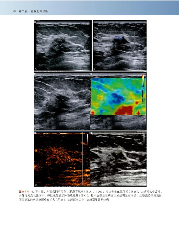 Book-Winshare Practical Breast Ultrasound Diagnosis and Interventional Treatment