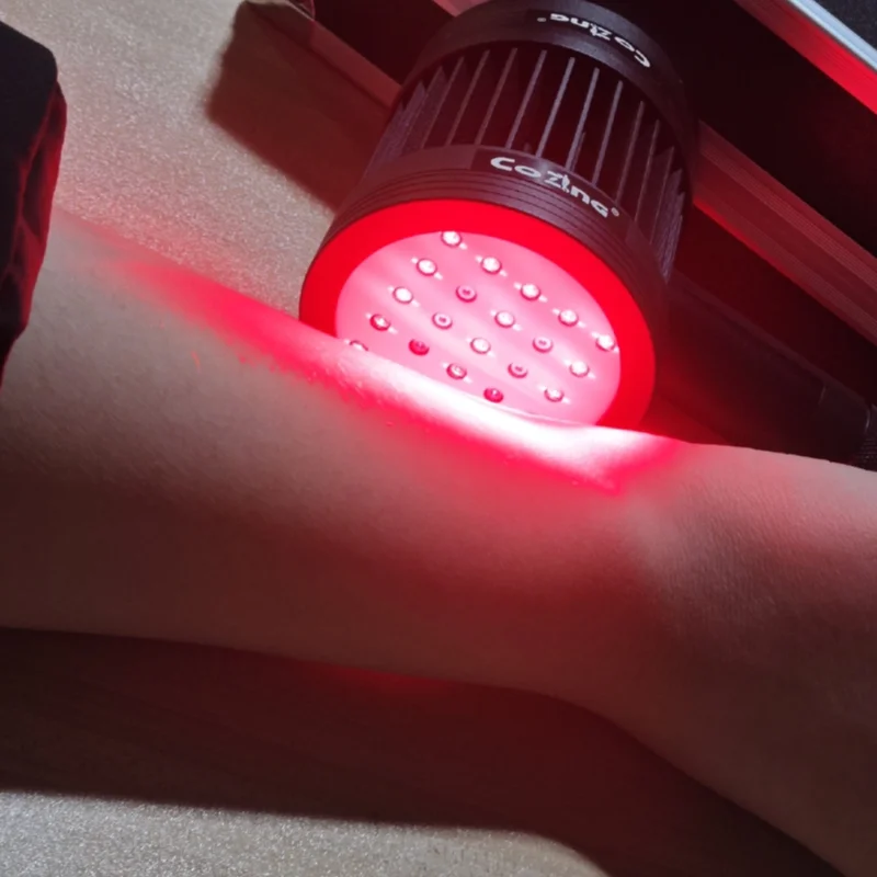 Advanced Therapeutic Cold Laser Massager 1295mW 808nm 650nm for Pain Management Relax Physiotherapy Recovery
