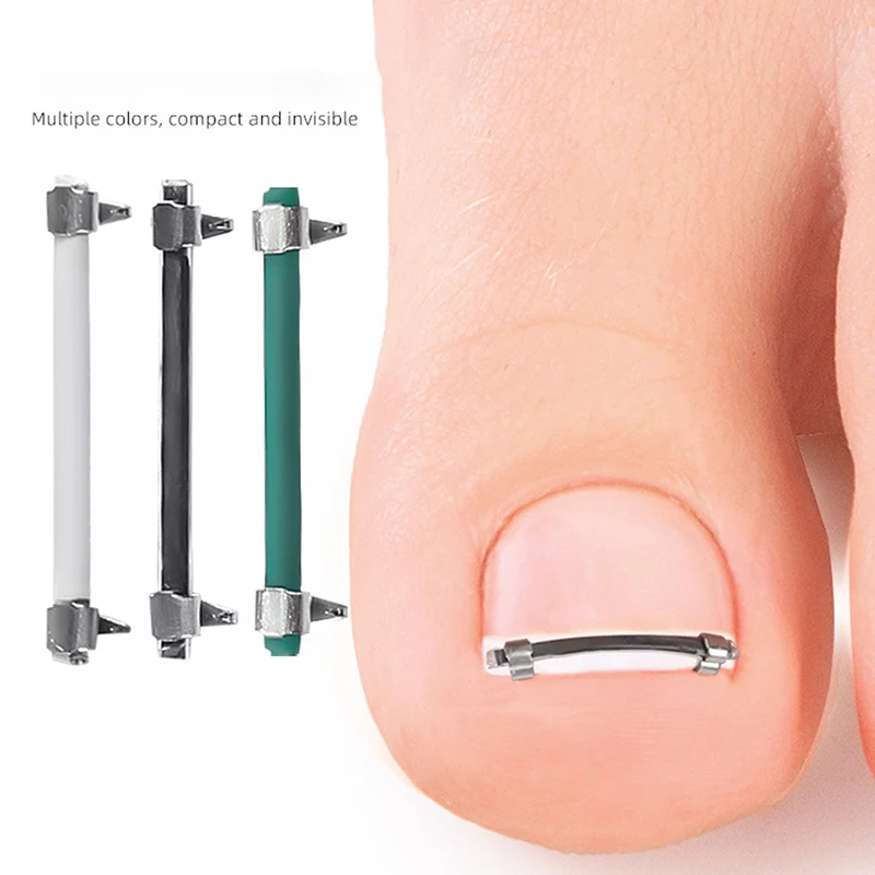 Ingrown Toenail Pedicure Tool - Curved Clamp Toe Nail Care Straightening Correction Clip for Toes - Embed Nail Care Tool