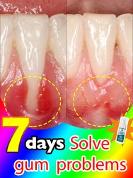 Solve all dental problems