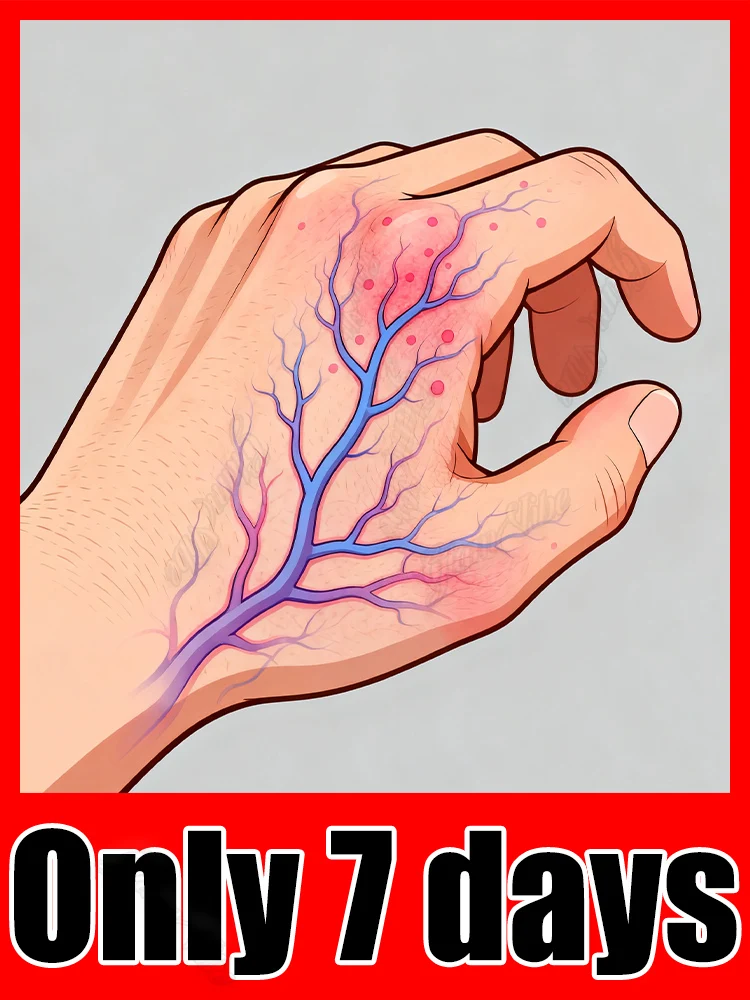 

Лазер может устранять васкулит и флебит, снимает боль в ногах паука и поставляется с лазерной указкой для лечения.