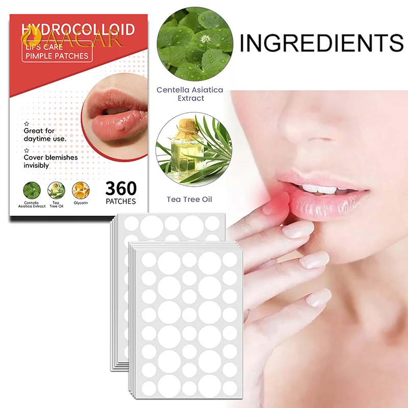 

360pcs Mouth Blister Patch Cold Sore Lip Blister Patch Cold Sore Healing Hydrocolloid Lip Care Stickers Mouth Blister Patch