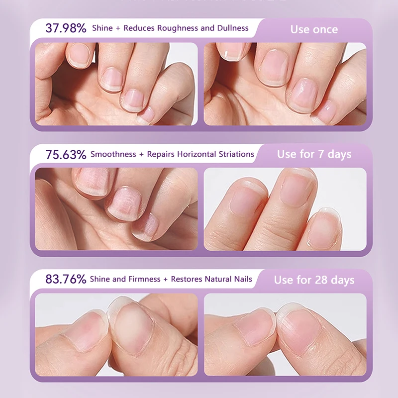 1pc cuticule poussoir ongles stylo à huile Portable en céramique cuticule huile poussoir stylo peau morte dissolvant outils ongles cuticule huile stylo