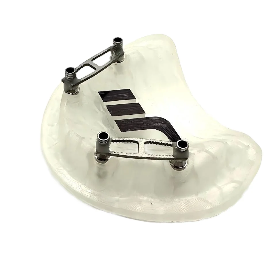 Dental Implant Splinting Bar 10Pcs Pack Serrated Connecting Bar for Temporary Bridge Reinforcement Impression Accuracy