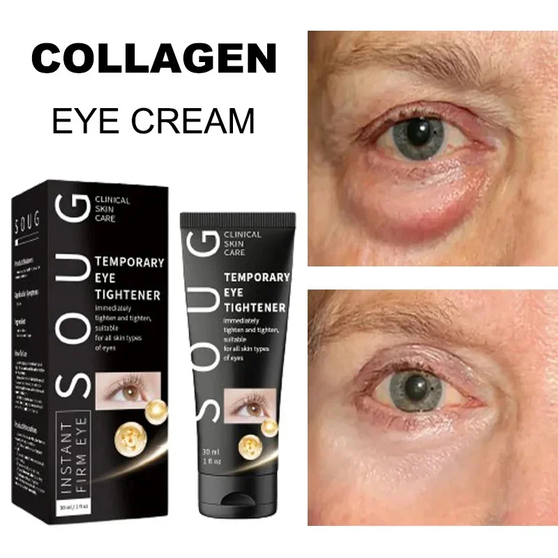 

Eye Cream Remove Eye Bags Puffiness Dark Circles Collagen Anti-Wrinkle Fade Fine Lines Whitening Moisturizing Skin Care For Men