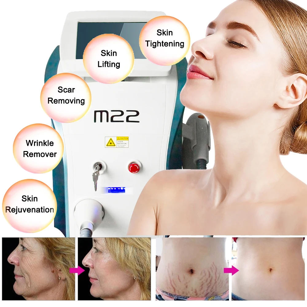 M22 Ipl Opt Skin Whiten Wrinkle Acne Skin Rejuvenation Permanent Hair Removal Facial Care Machine