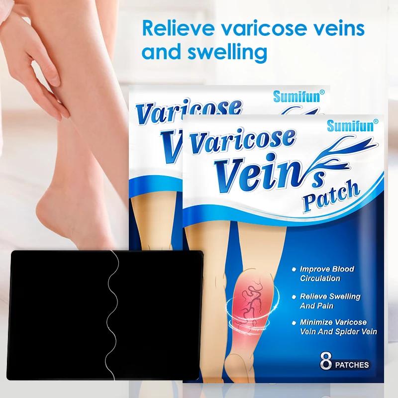 Sumifun Varicose Vein Cream Varicosity Angiitis Spider Removal Legs Dilated Treatments Patch Phlebitis Pain Relief Health Care