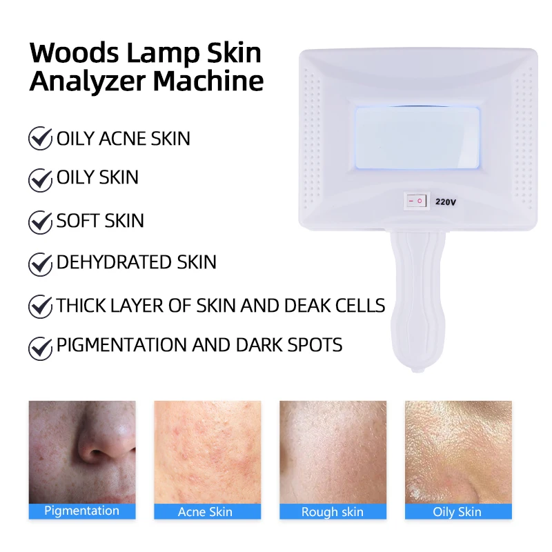 Analyseur de peau de Machine d'analyse de peau de lampe de bois pour la détection fongique, la pigmentation et la diagnostic de l'acné moniteur effets de soins de la peau