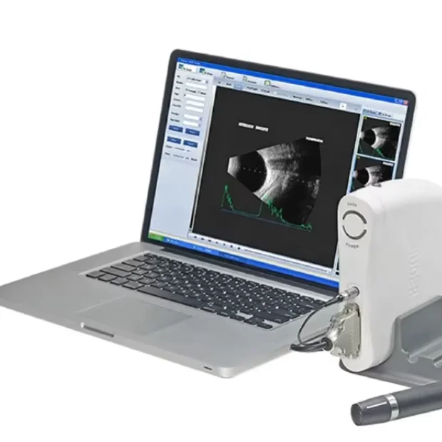 SW-2100  USB interfaced ophthalmic Av/B scan with best quality and precise data Ophthalmic A/B Scan Portable A/B scan