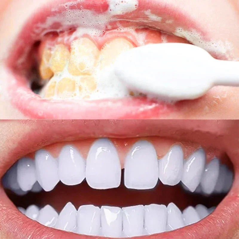 whitening teeth toothpaste dental calculus remover mouth odour removal bad breath Preventing Periodontitis fluoride toothpaste.