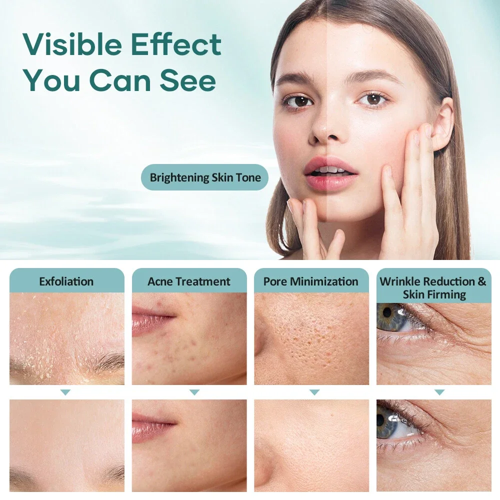 7 في 1 أكوا تقشير H2O2 آلة الوجه هيدرا المياه جلدي الجلد الغسيل قشر الأكسجين آلة الوجه النفاثة #3