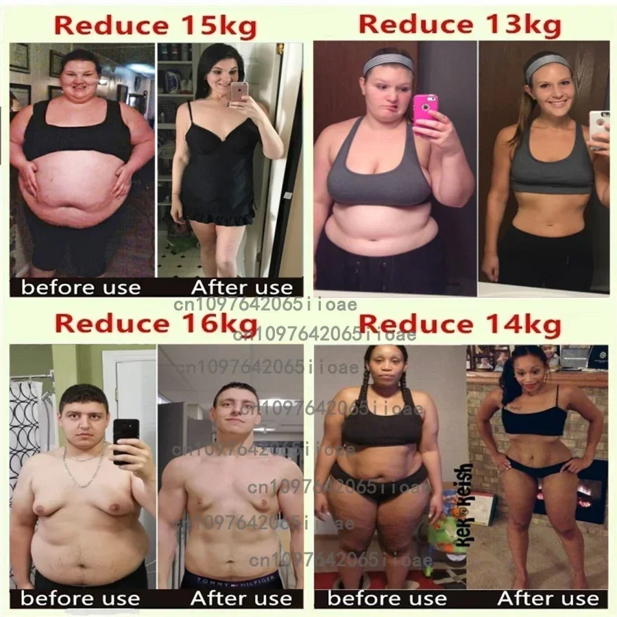30 Patches Fat Burner Raspberry Ketones Detox Slimming Belly Promotes Metabolism and Fat Burning Transdermal Patches