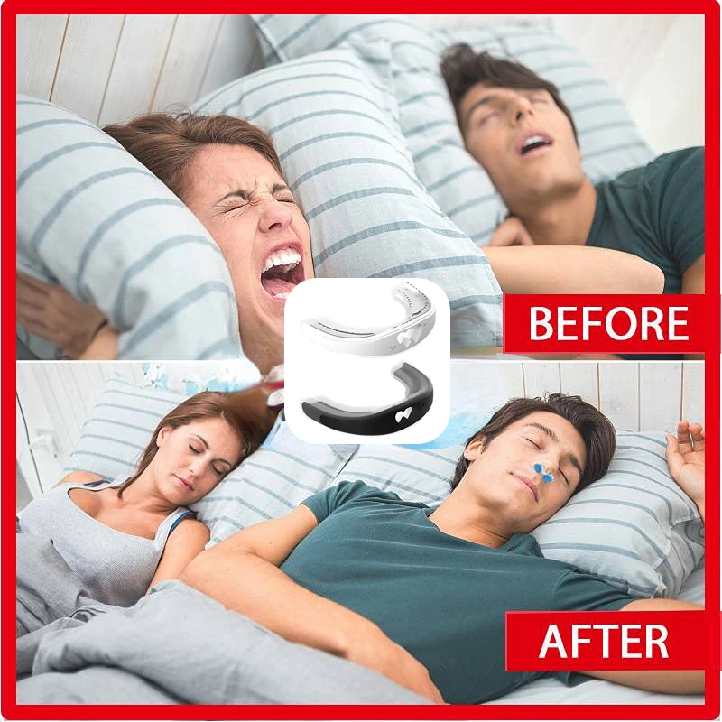 

Anti-snoring Mouth Guard Sleep Food Grade Silicone Bracket Clip Stop Snoring Nose Nasal For better Breath Aid Apnea Guard Night