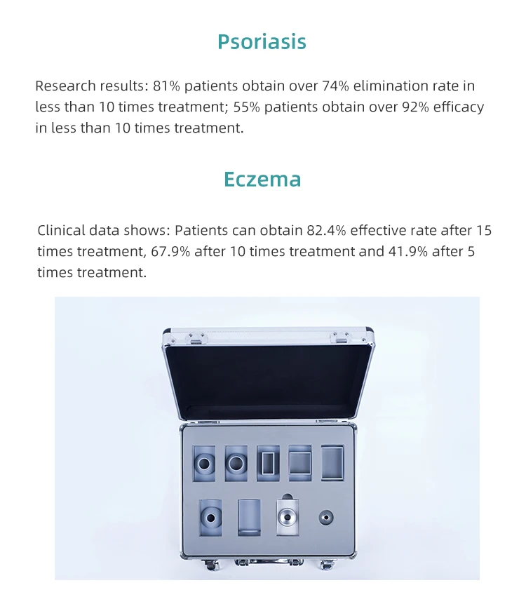 GSD 2020 Macchina laser per vitiligine e psoriasi con laser ad eccimeri per la cura della pelle dal design professionale superiore 308nm