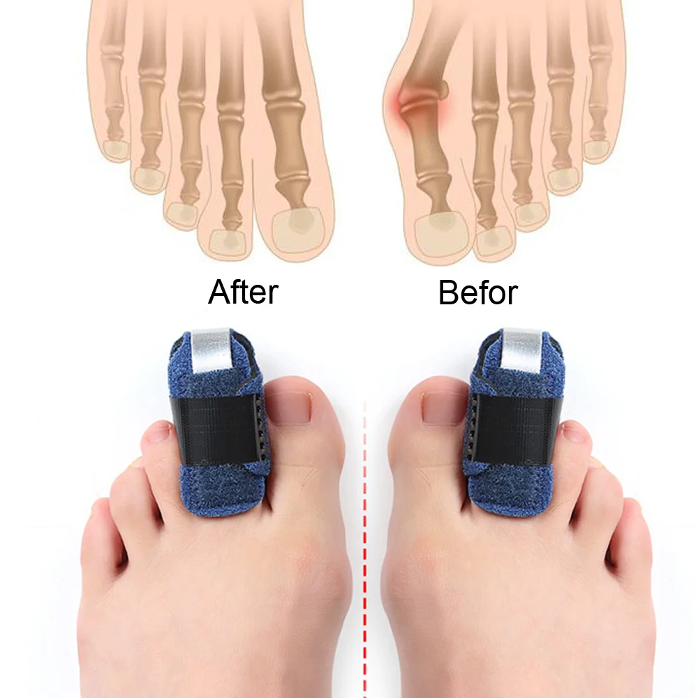 Hammer Toe Corrector Splint Straightener Crooked Claw Toe Stabilizer Support Brace Wrap Pain Relief Kids Adults KOTLIKOFF