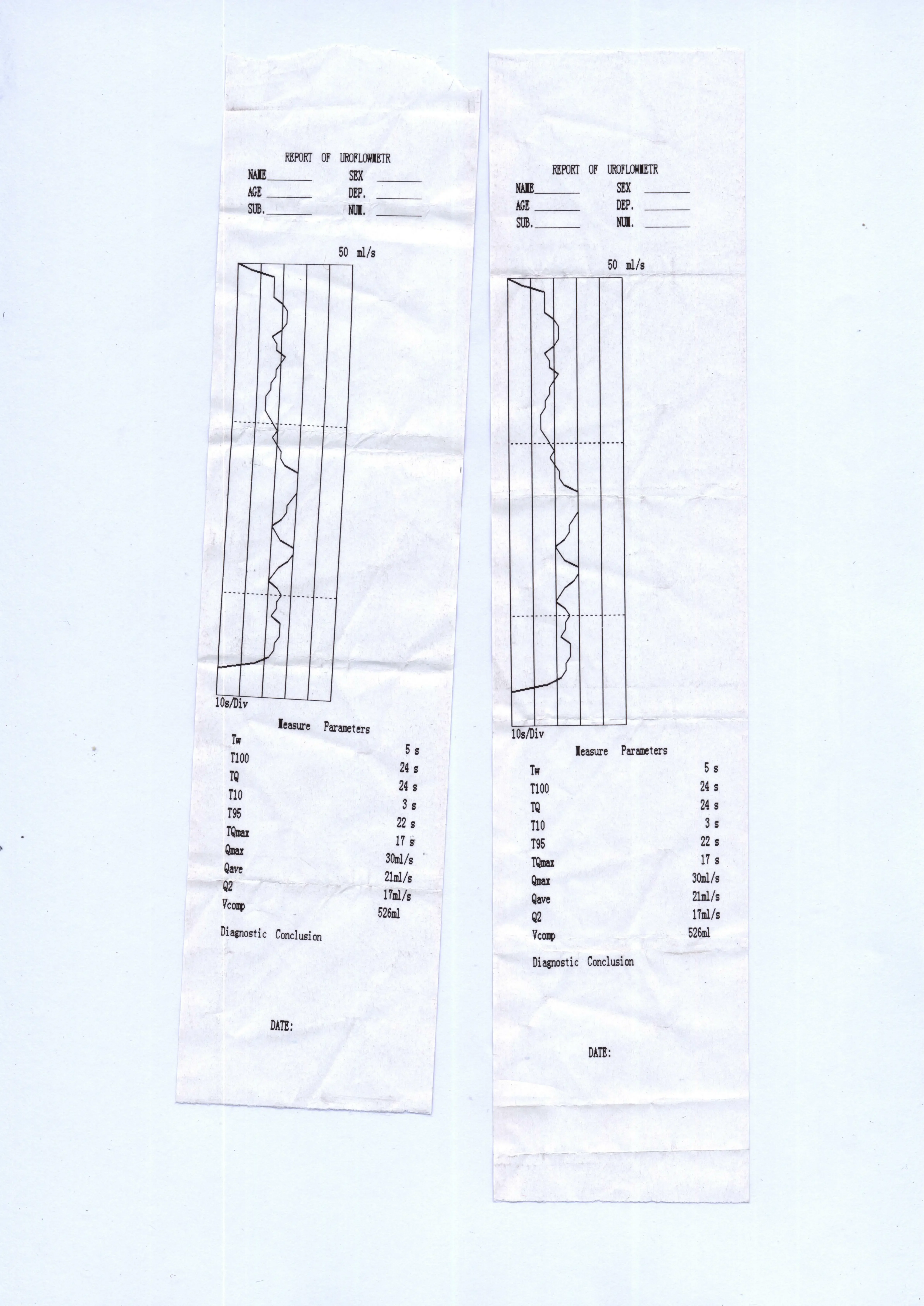 SY-B169A Uroflowmetry Equipment urine measurement   hine Urine Flow Meter uroflowmeter