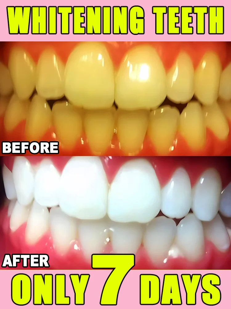 

Brush your teeth to make them whiter and more confident