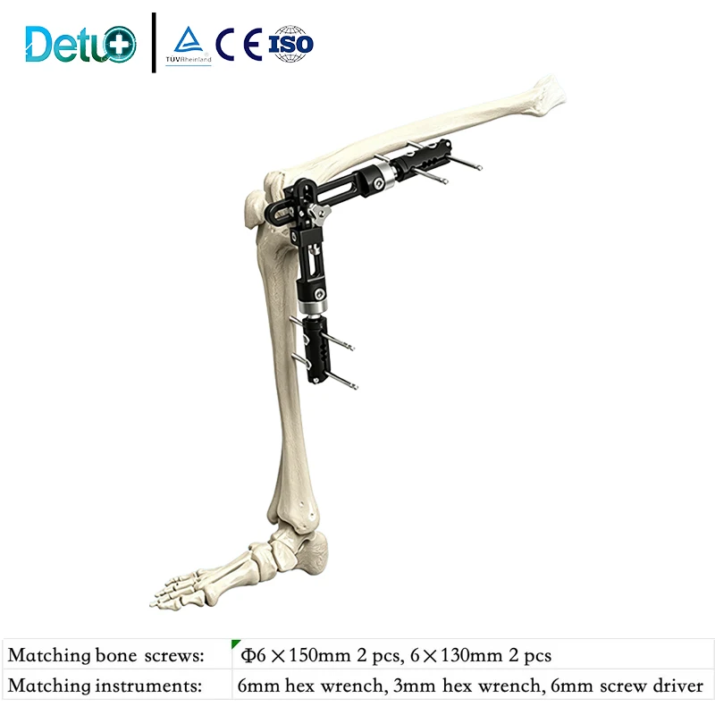 Aluminum Alloy Knee Joint External Fixator Single-sided Integrated Surgical System Orthopedic  For Knee Fractures CE ISO